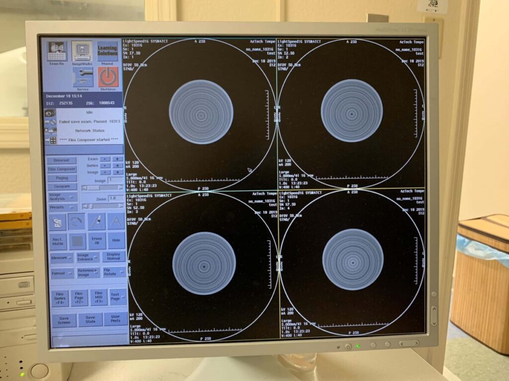 Picture of CT artifact