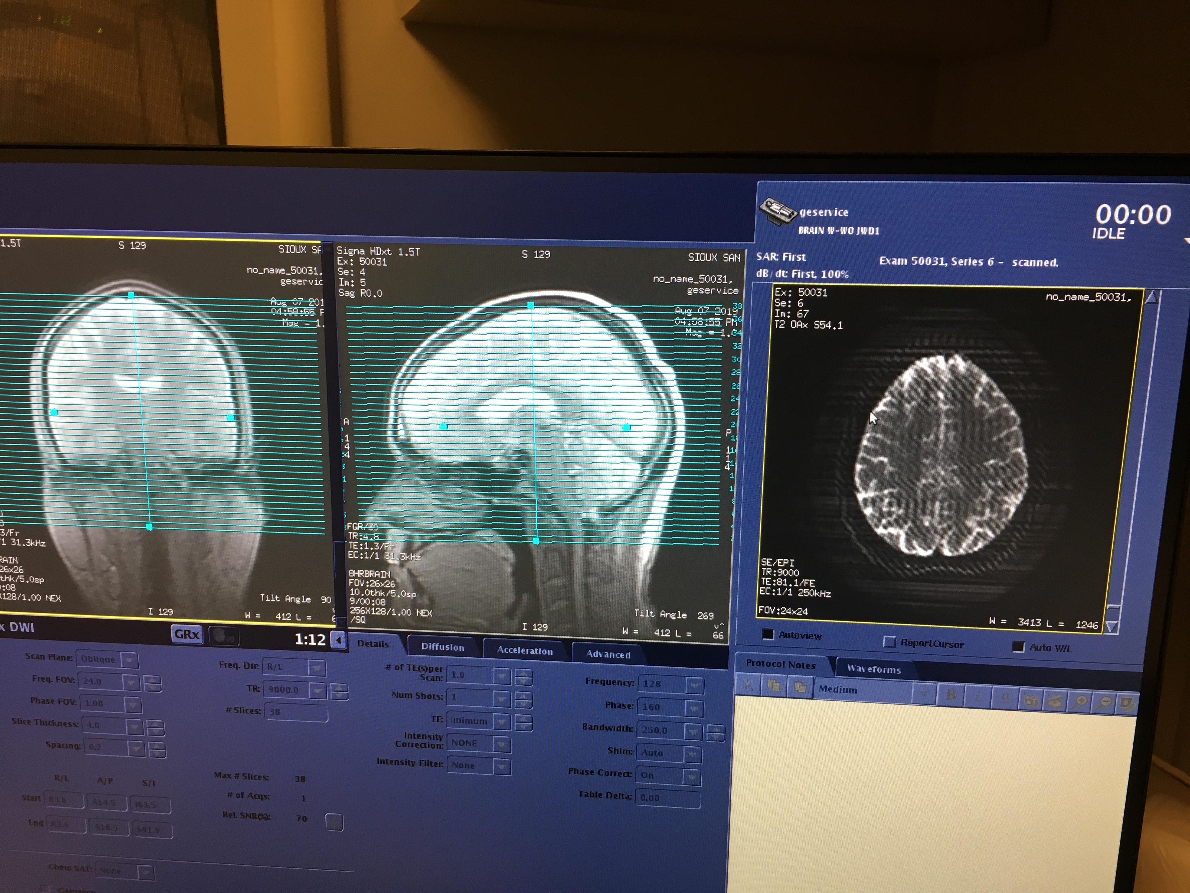 mri scan localizer images brain scan