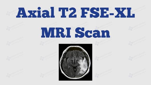 brain MRI scan sounds, brain mri, axial t2 mri