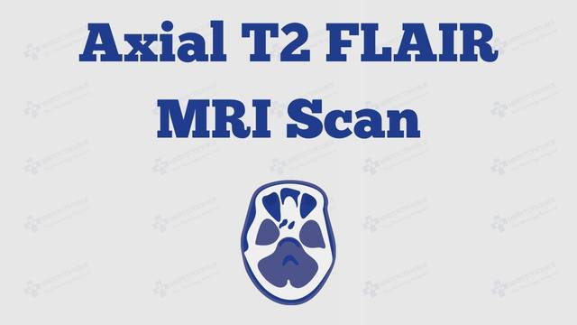 axial t2 flair mri, brain mri scan sounds