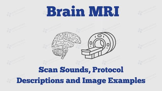 Brain MRI scan sounds, images, and description