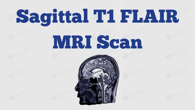 Brain MRI Sagittal T1 FLAIR sequence, brain mri scan sounds