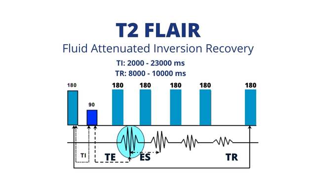t2 flair mri protocol sequence 