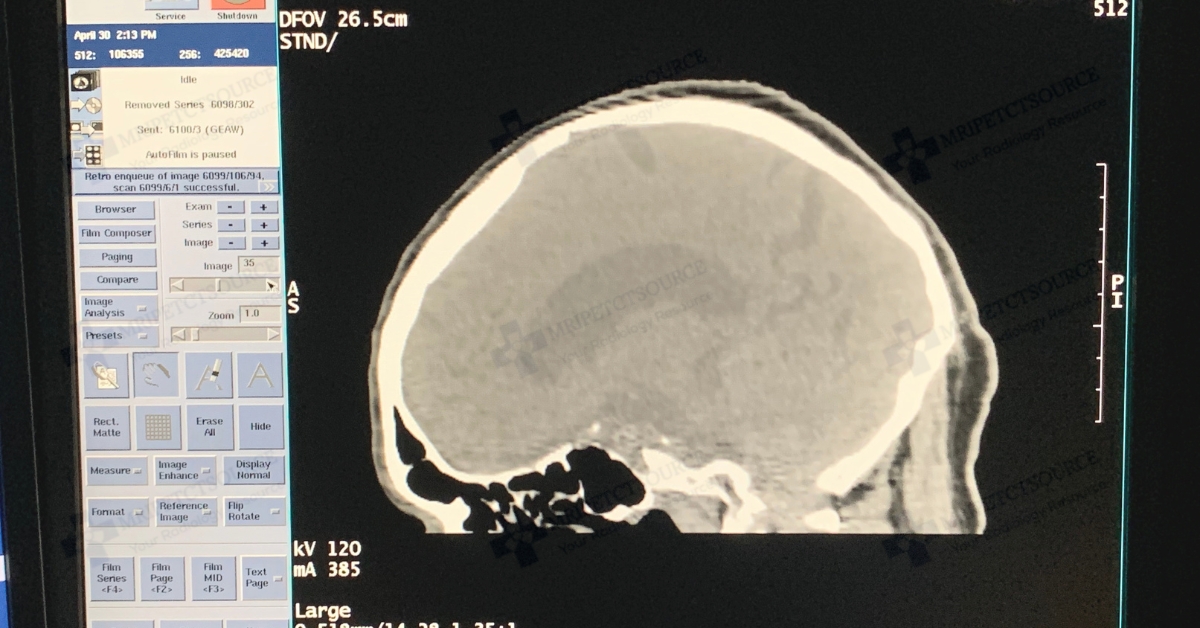 CT scanner image example, ct brain scan, head ct scan