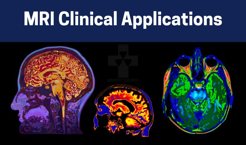 best mri books for beginners, mri books, books on mri, radiology technician books, t1 vs t2 mri mnemonic, mri textbooks, mri physics book, books for radiology technician, mri textbook, mri in practice, best book for radiology mbbs, best radiology books, mri in practice book