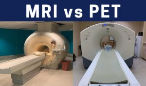 MRI vs PET scan. facts about PET scan