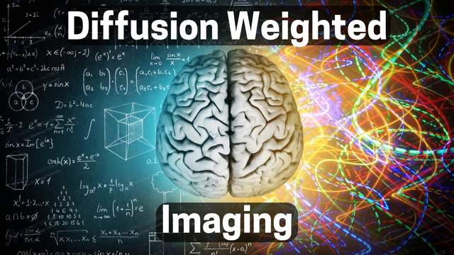 diffusion weighted imaging, dwi in mri, dwi mri