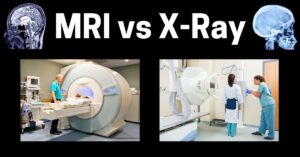 ct scan vs mri, mri vs xray, mri vs ct scan, difference between mri and ct scan, ct vs mri, difference between ct and mri, difference between mri and xray, mri vs x ray, ct scan vs xray, x ray vs mri, mri vs ct, xray vs mri, difference between mri and ct, mri and x-ray, difference between an xray and an mri, mri and xray difference, xray vs ct scan, difference between x ray and ct scan and mri, difference between mri and x ray, mri vs x-ray, is mri an xray, what is the difference between ct and mri, difference between x ray and mri, mri vs x ray which is safer, difference between a ct scan and an mri