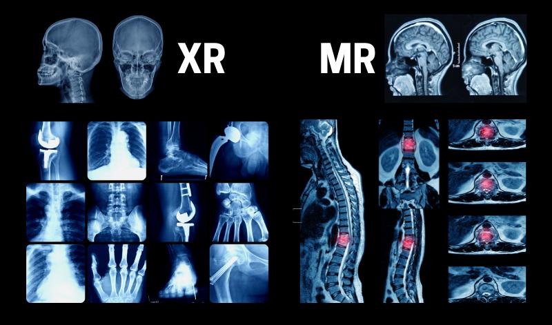 xray vs mri, mri vs xray, mri vs xray inforgaphic, xray vs mri inforgaphic, xr vs mr