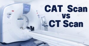 cat scan vs ct scan, ct scan vs cat scan, ct vs cat scan, cat vs ct scan, cat scan vs ct, ct vs cat, is ct scan same as cat scan, difference between cat scan and ct scan, cat vs ct, cat scan, what is the difference between a ct scan and a cat scan, is ct and cat scan the same, is a ct scan the same as a cat scan, is a cat scan the same as a ct scan, what is the difference between a cat scan and a ct scan, what's the difference between a cat scan and a ct scan, ct versus cat scan, ct scan versus cat scan, ct scan cat scan difference, ct scan same as cat scan