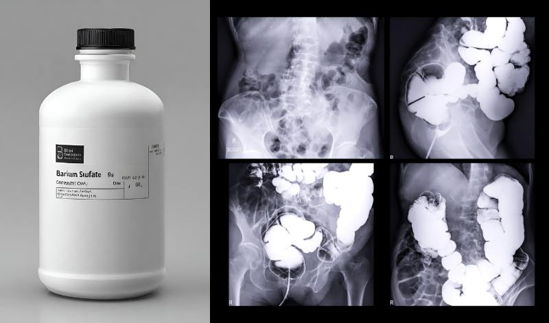 mri vs ct scan, ct scan vs mri, ct scan vs mri