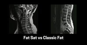 GE MRI Fat vs Fat Classic