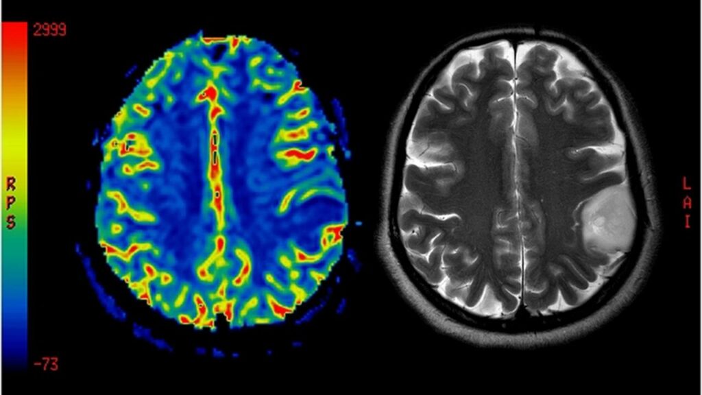 functional mri scan, mri scan parameters tradeoff