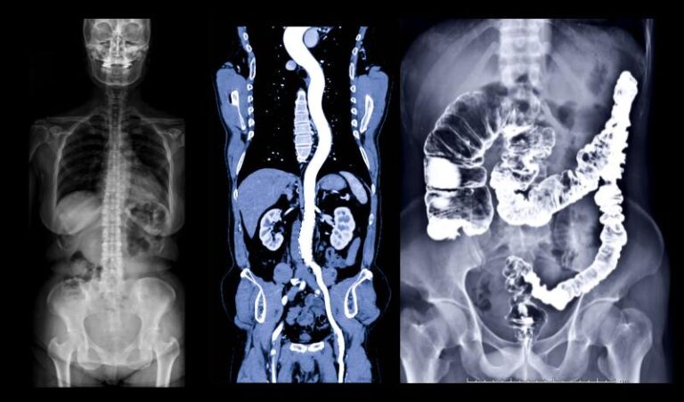 Contrast Media in Radiology: MRI, CT & PET Explained ...