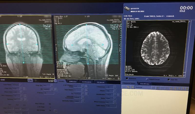 mri brain scan, mri software