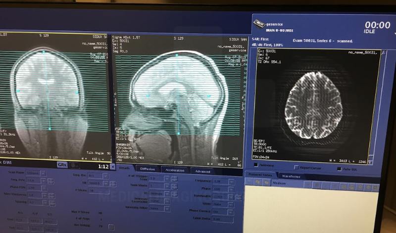 mri scan images, brain mri scan