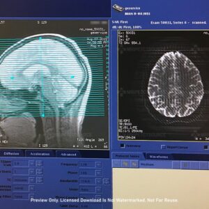 3T Brain MRI Scan