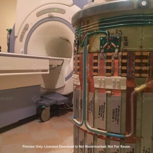 MRI RF Coil