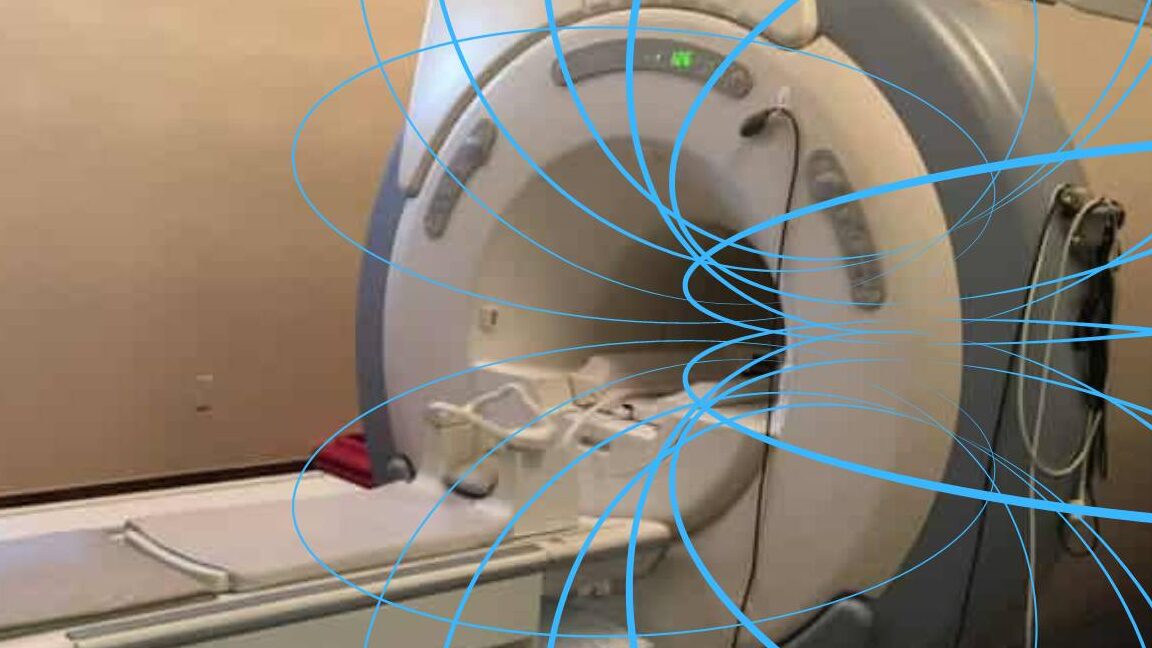 mri terms and definitions mri scanner gradient fields electromagnetic, gauss, gauss in MRI