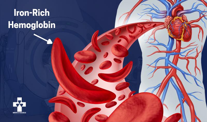 blood in mri, hemoglobin, iron in blood mri, is blood pulled by mri, is blood attracted to MRI