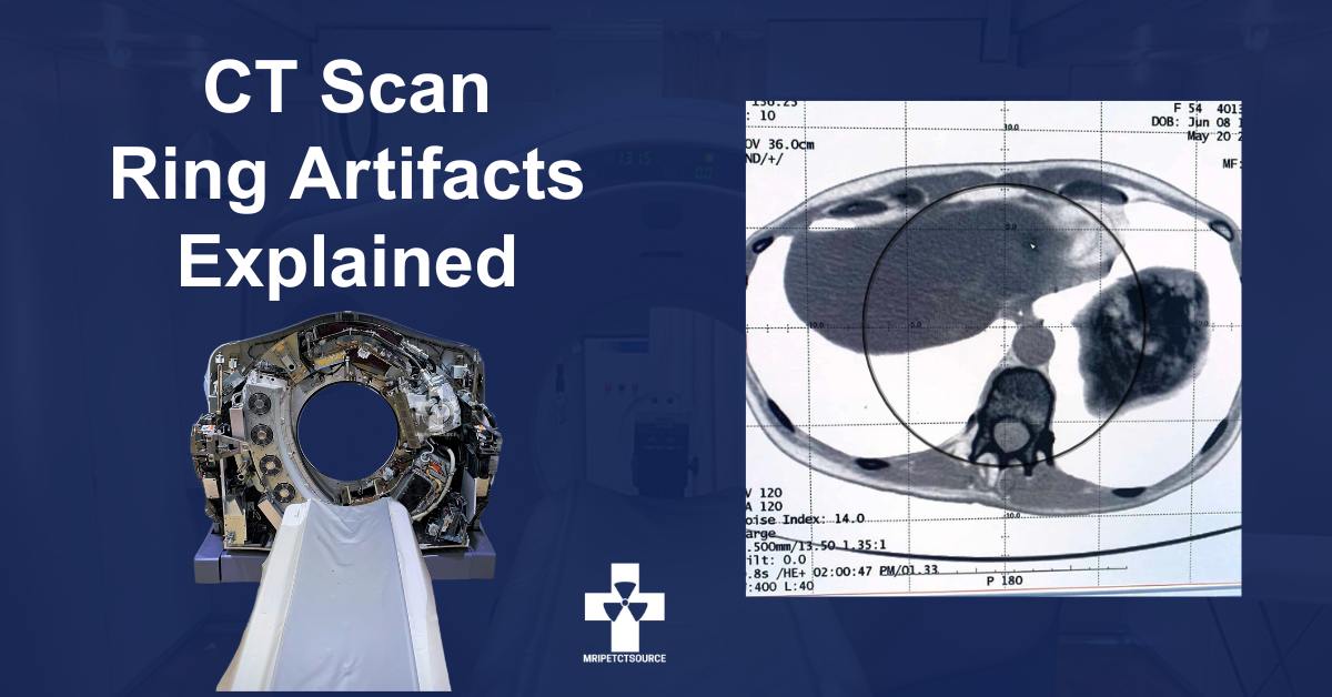 CT scan ring artifact explained. CT scan machine pictured left, CT ring artifact example pictured right.